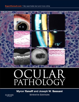 Ocular Pathology 1455728748 Book Cover