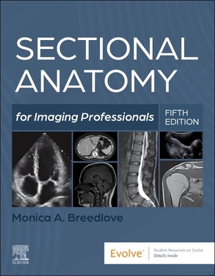 Sectional Anatomy for Imaging Professionals 0323827888 Book Cover