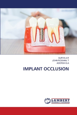 Implant Occlusion 620765269X Book Cover