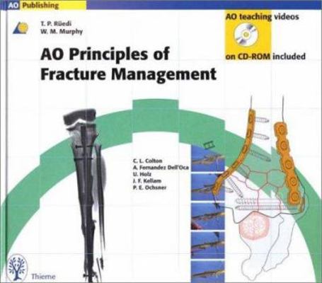 Principles of Fracture Management 0865778868 Book Cover