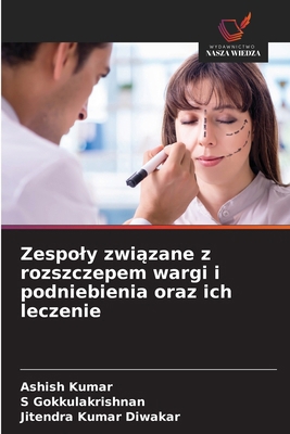 Zespoly zwi&#261;zane z rozszczepem wargi i pod... [Polish] 6202334967 Book Cover
