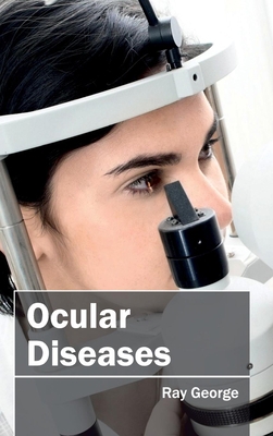 Ocular Diseases 1632413035 Book Cover