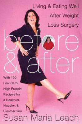 Before & After: Living & Eating Well After Weig... 0060567228 Book Cover