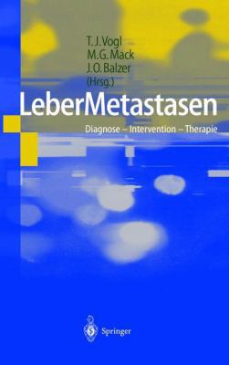 Lebermetastasen: Diagnose -- Intervention -- Th... [German] 3642639585 Book Cover