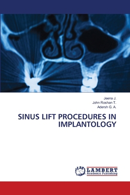 Sinus Lift Procedures in Implantology 6207995112 Book Cover