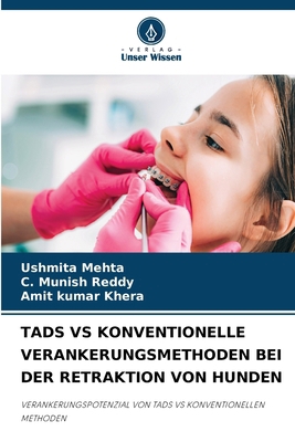 Tads Vs Konventionelle Verankerungsmethoden Bei... [German] 6208254698 Book Cover