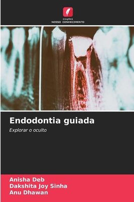 Endodontia guiada [Portuguese] 6207547152 Book Cover