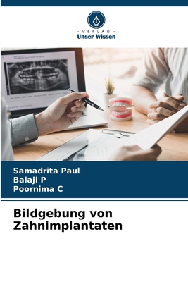 Bildgebung von Zahnimplantaten [German] 6208558662 Book Cover