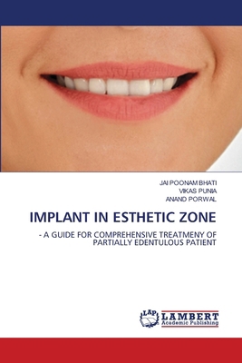 Implant in Esthetic Zone 6205630486 Book Cover