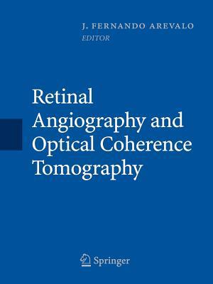 Retinal Angiography and Optical Coherence Tomog... 1493938843 Book Cover