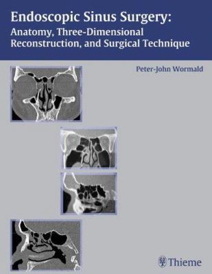 Endoscopic Sinus Surgery: Anatomy, Three-Dimens... 1588902854 Book Cover