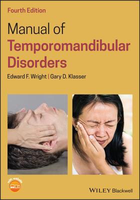 Manual of Temporomandibular Disorders 1119548845 Book Cover