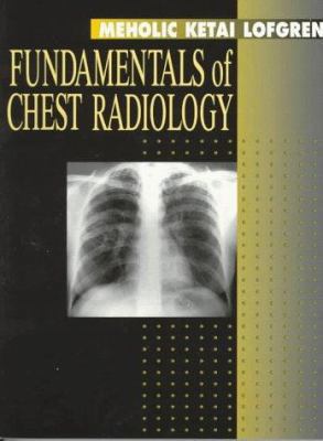 Fundamentals of Chest Radiology (Fundamentals o... 0721654002 Book Cover