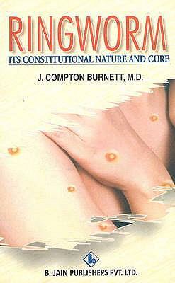 Ringworm: Its Constitutional Nature and Cure 8170216818 Book Cover