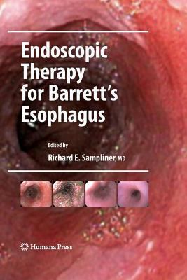 Endoscopic Therapy for Barrett's Esophagus 1493961195 Book Cover