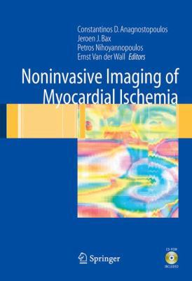 Noninvasive Imaging of Myocardial Ischemia 1846280273 Book Cover