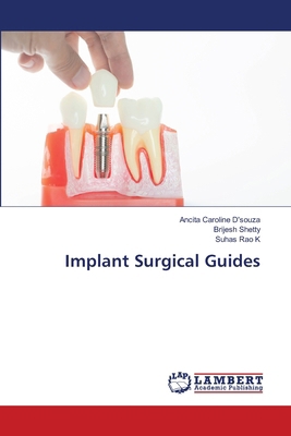 Implant Surgical Guides 6208009618 Book Cover