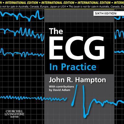 The ECG In Practice 0702046442 Book Cover