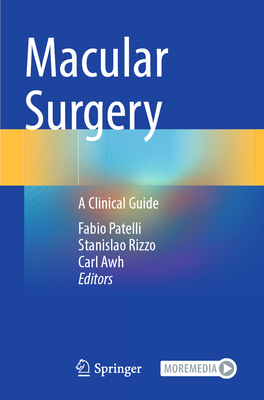 Macular Surgery: A Clinical Guide 3031635108 Book Cover