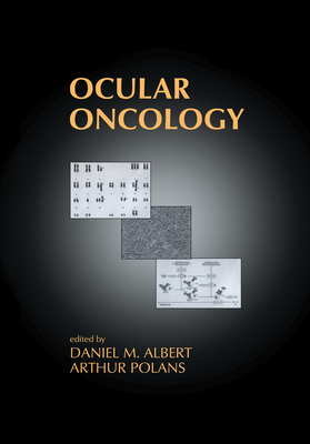 Ocular Oncology 0824740165 Book Cover