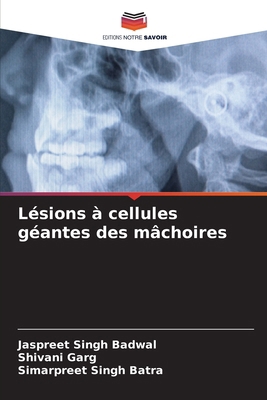 Lésions à cellules géantes des mâchoires [French] 6208357535 Book Cover