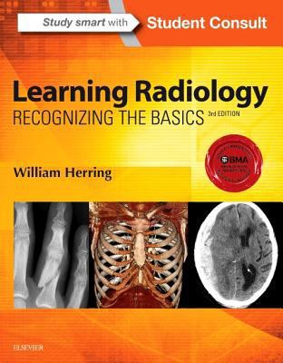 Learning Radiology: Recognizing the Basics 0323328075 Book Cover