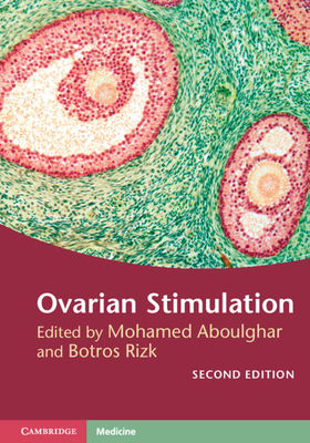Ovarian Stimulation 1107135974 Book Cover