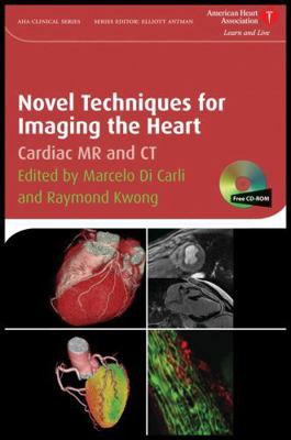Novel Techniques for Imaging the Heart: Cardiac... 1405175338 Book Cover