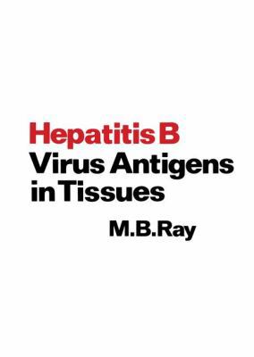 Hepatitis B Virus Antigens in Tissues 9401162379 Book Cover