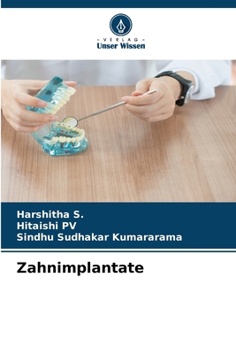 Zahnimplantate [German] 6630074068 Book Cover