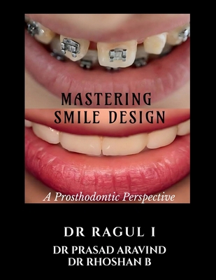 Mastering Smile Design: A Prosthodontic Perspec... B0FL86QWVP Book Cover