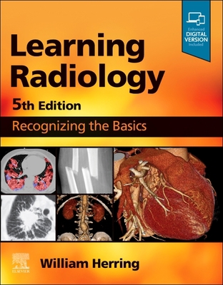 Learning Radiology: Recognizing the Basics 0323878172 Book Cover