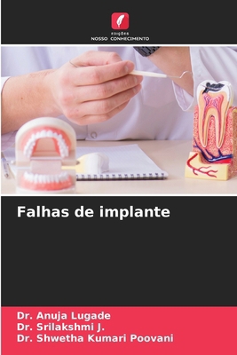 Falhas de implante [Portuguese] 6207967429 Book Cover