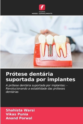 Prótese dentária suportada por implantes [Portuguese] 6209243061 Book Cover