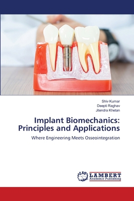 Implant Biomechanics: Principles and Applications 3659636622 Book Cover