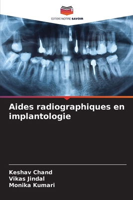 Aides radiographiques en implantologie [French] 6208618126 Book Cover