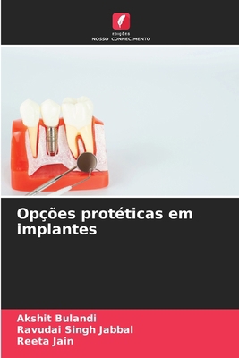 Opções protéticas em implantes [Portuguese] 6209468691 Book Cover