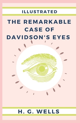 The Remarkable Case of Davidson's Eyes Illustrated