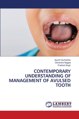Contemporary Understanding of Management of Avu... 6208427150 Book Cover