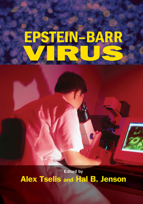 Epstein-Barr Virus 0367391066 Book Cover