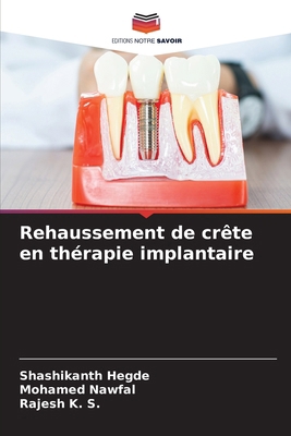 Rehaussement de crête en thérapie implantaire [French] 6208292964 Book Cover