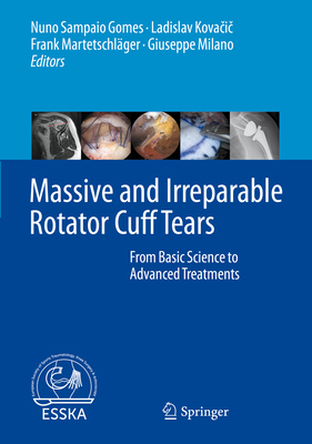 Massive and Irreparable Rotator Cuff Tears: Fro... 3662611619 Book Cover