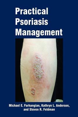 Practical Psoriasis Management 151514769X Book Cover