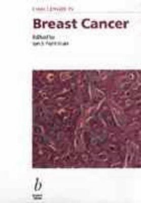 Challenges in Breast Cancer B000VYT1NW Book Cover