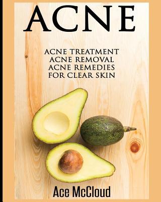 Acne: Acne Treatment: Acne Removal: Acne Remedi... 1640480013 Book Cover