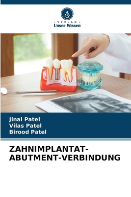 Zahnimplantat-Abutment-Verbindung [German] 6207763734 Book Cover