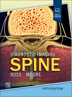 Diagnostic Imaging: Spine 0443378819 Book Cover