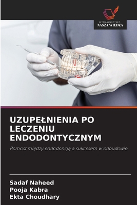 Uzupelnienia Po Leczeniu Endodontycznym [Polish] 6209229360 Book Cover