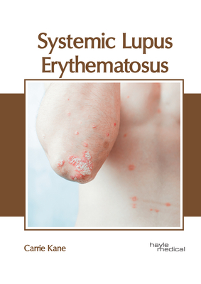 Systemic Lupus Erythematosus 1632418681 Book Cover