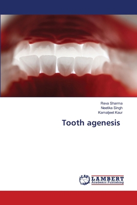 Tooth agenesis 6207653432 Book Cover